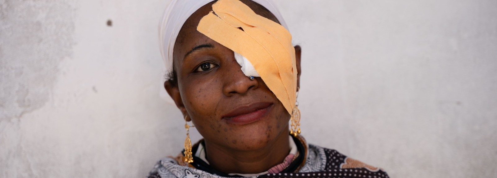 Fighting trachoma: Empowering communities for sustainable health solutions